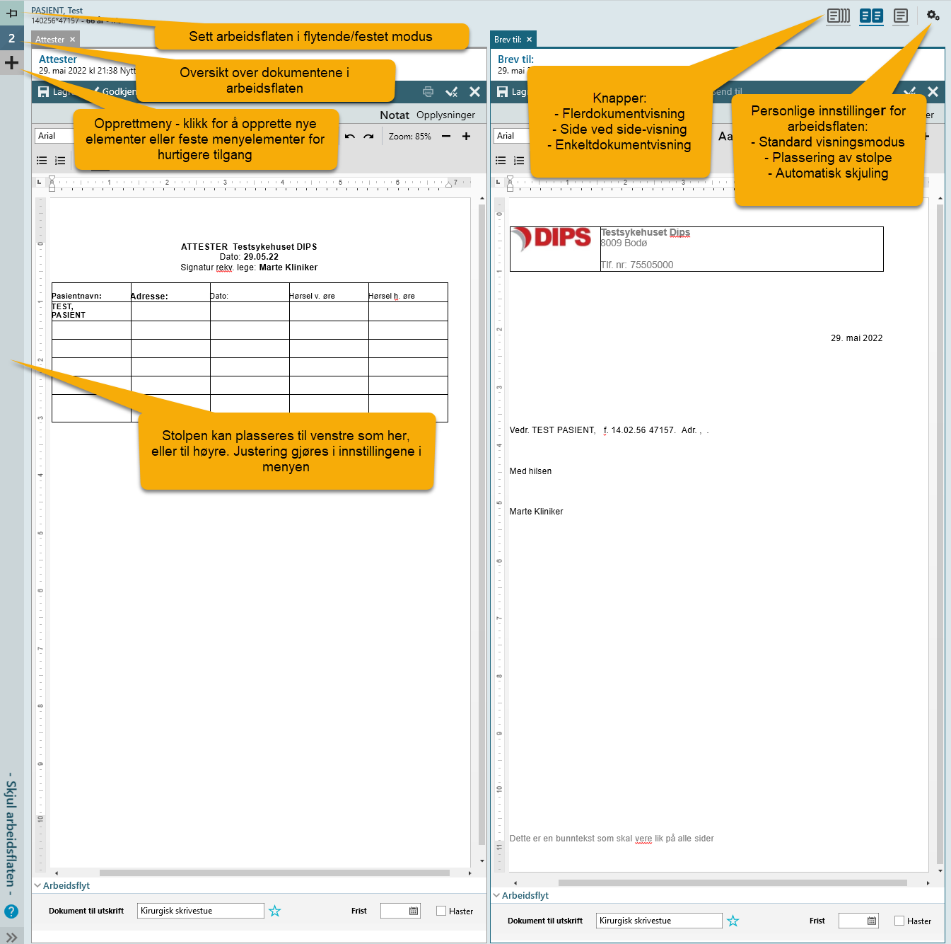 Arbeidsflaten i Arena