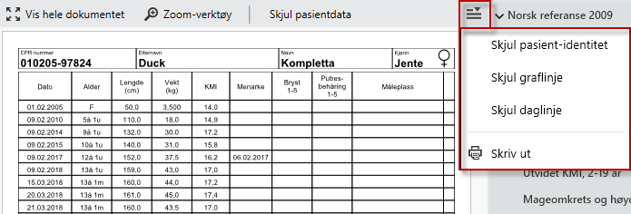 Tilgjengelige funksjoner for kurvevisning vist med meny