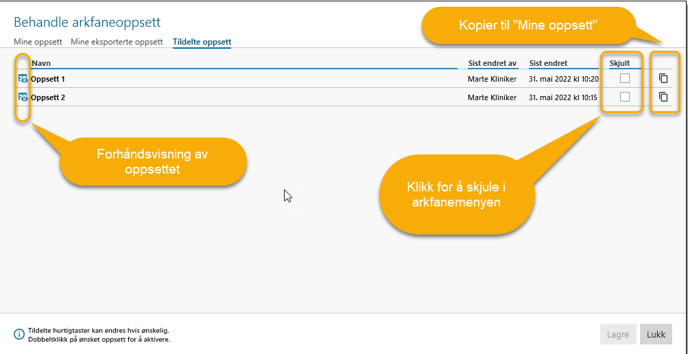 Funksjoner i arkfane for Tildelte oppsett